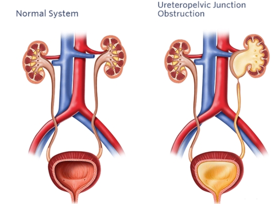 Ritvik-Kidney-Centre