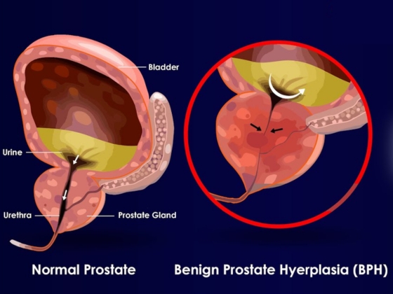 Ritvik-Kidney-Centre