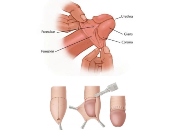 Ritvik-Kidney-Centre