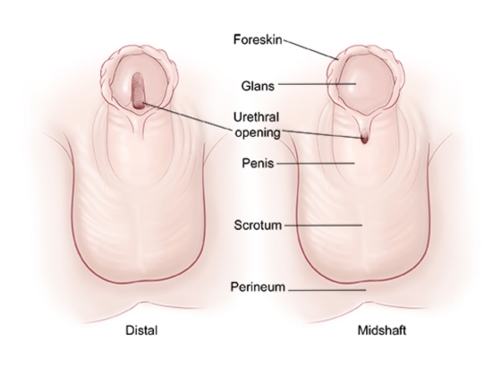 Ritvik-Kidney-Centre