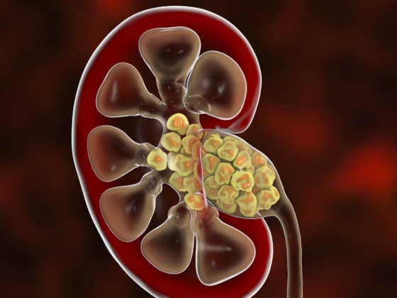 Ritvik-Kidney-Centre