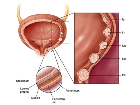 Ritvik-Kidney-Centre