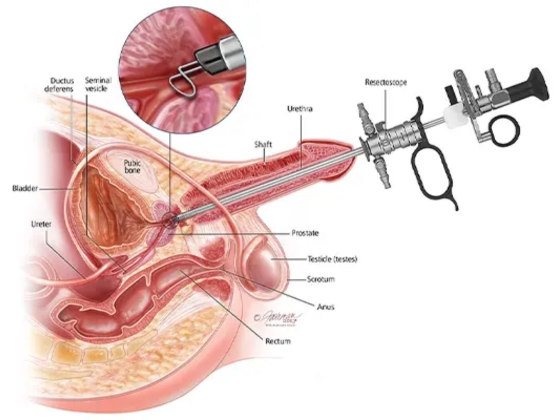 Ritvik-Kidney-Centre