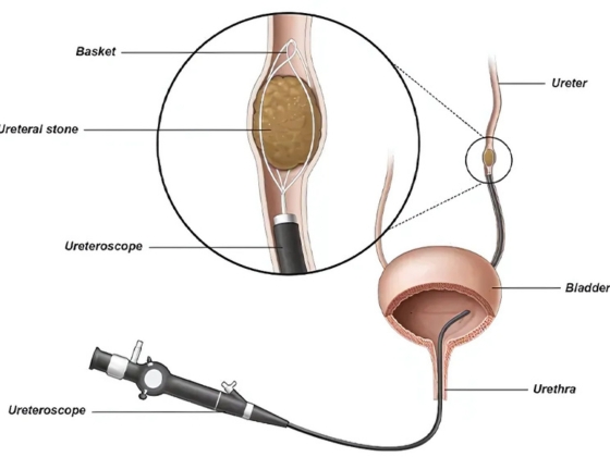 Ritvik-Kidney-Centre