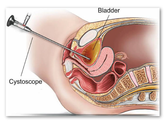 Ritvik-Kidney-Centre