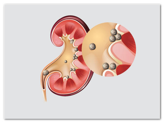 Ritvik-Kidney-Centre