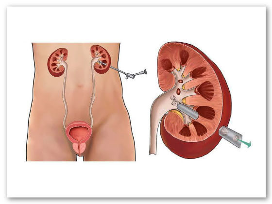 Ritvik-Kidney-Centre