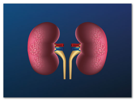 best-prostate-cancer-treatment-in-Habsiguda