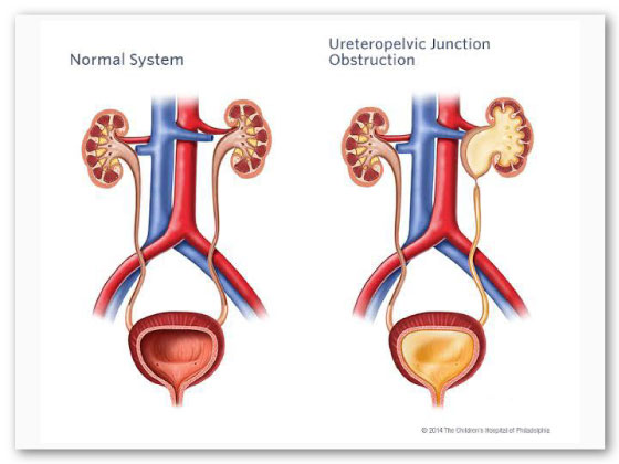 Ritvik-Kidney-Centre