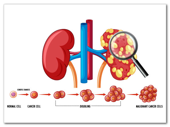 Ritvik-Kidney-Centre