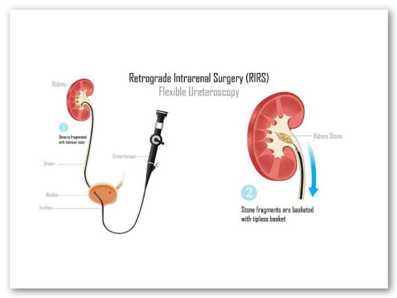 Ritvik-Kidney-Centre