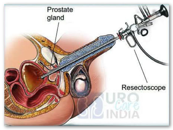 Ritvik-Kidney-Centre